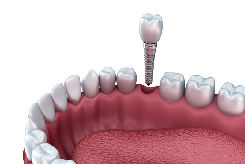 Any Job for Dental Health and wellbeing during Overall wellness